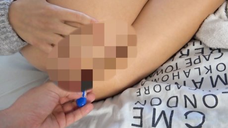 Ill? Doctor inserts his giant thermometer rectally! 2